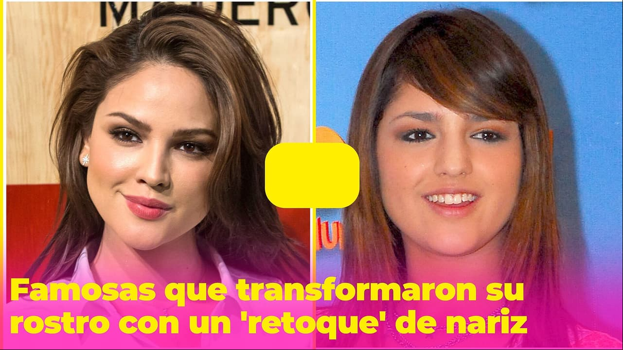 Famosas que transformaron por completo su rostro tras un cambio de nariz