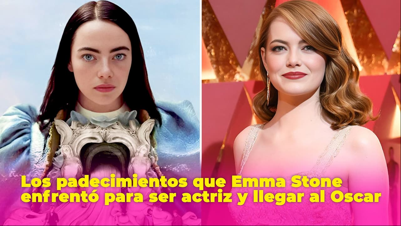Emma Stone tuvo que ir a terapia para ser actriz: le diagnosticaron 2 padecimiento que la limitaban