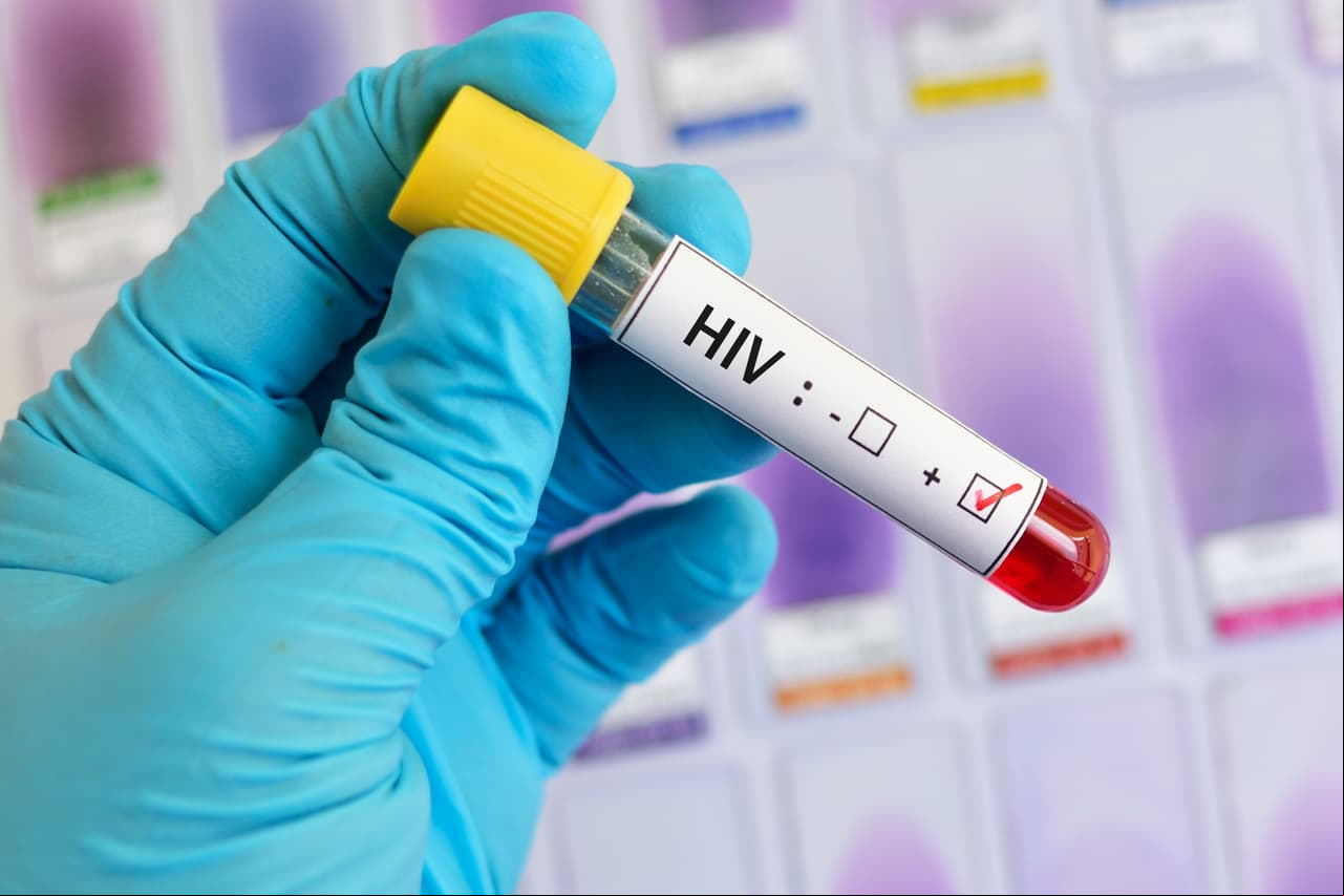 Logran eliminar virus de VIH en seis pacientes… ¡descubre cómo!