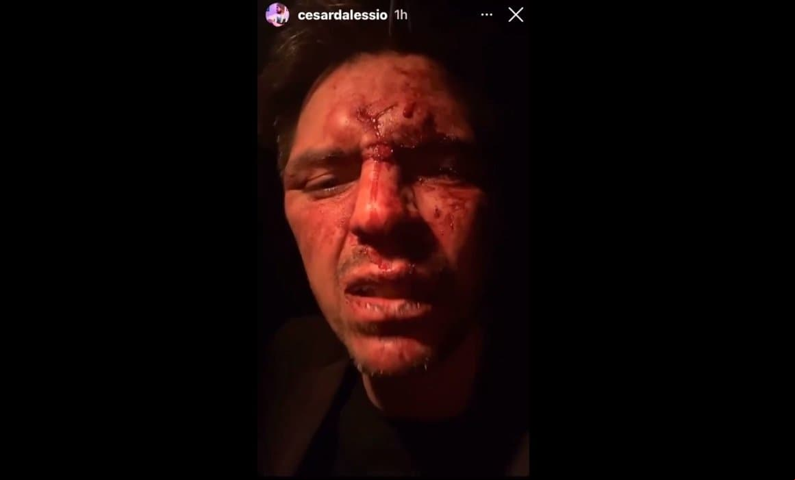 César D'Alessio apareció con la cara ensangrentada, mientras relataba lo sucedido