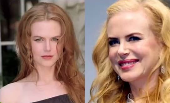 VIDEO: ¡Conoce a los famosos que perdieron su encanto por las cirugías!