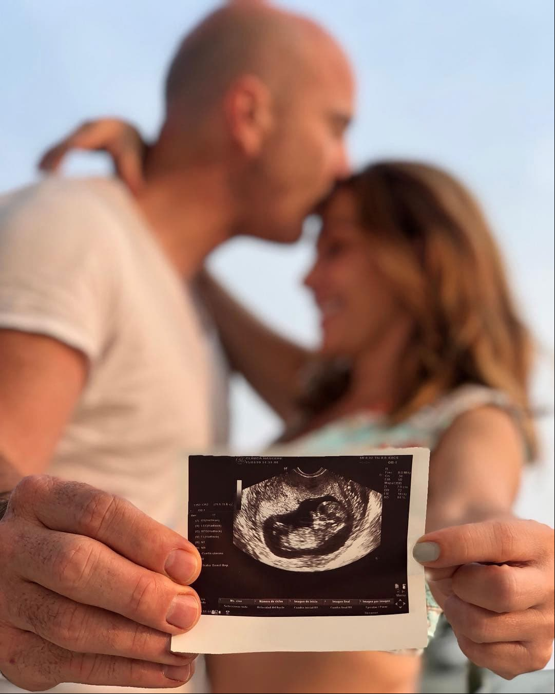 “No puedo más que agradecer a Dios y a la vida por tener el privilegio de vivir las sensaciones que hoy me llenan el corazón. Preparo mi mente y mi cuerpo para pronto recibir a este bebé que nos eligió para ser sus papás”, escribió la cantante en Instagram.