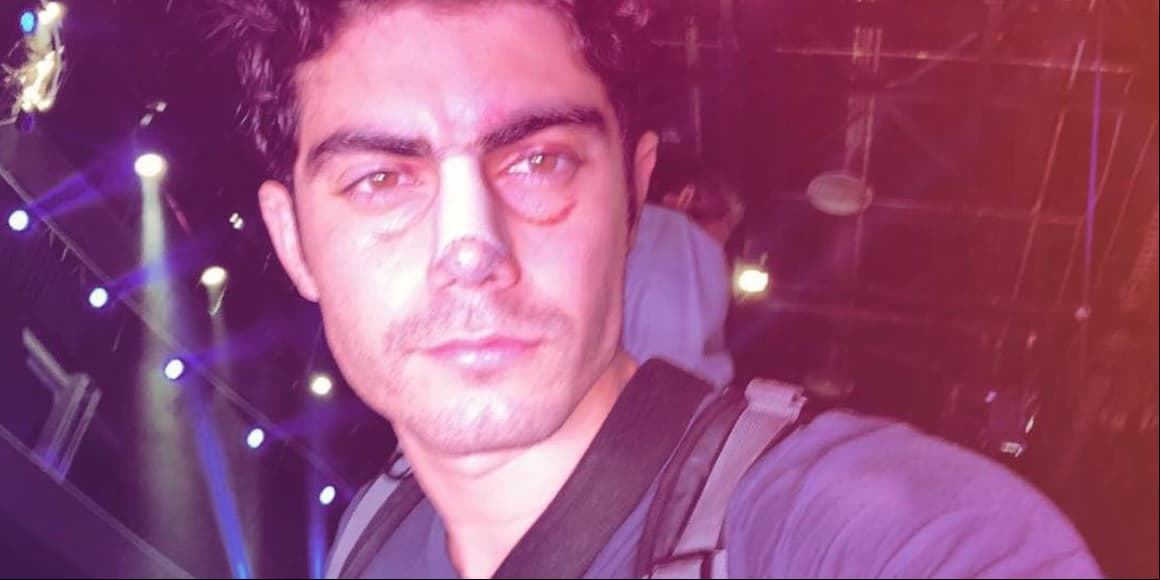 Atropellan a actor que interpretó a Juan Gabriel