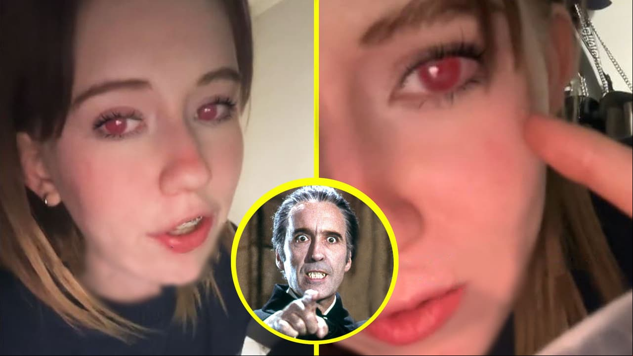 ¿Es vampira? Mujer causa impacto en TikTok por tener ojos rojos: la verdad científica detrás