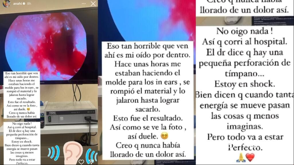 Anahí reveló que el diagnóstico que recibió es que sufrió un "pequeño rompimiento de tímpano".