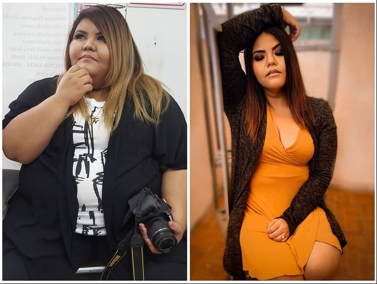 Yuliana Martínez reveló en redes sociales que el primer paso de su transformación fue someterse a una cirugía, la cual le ayudó a perder peso más rápido.