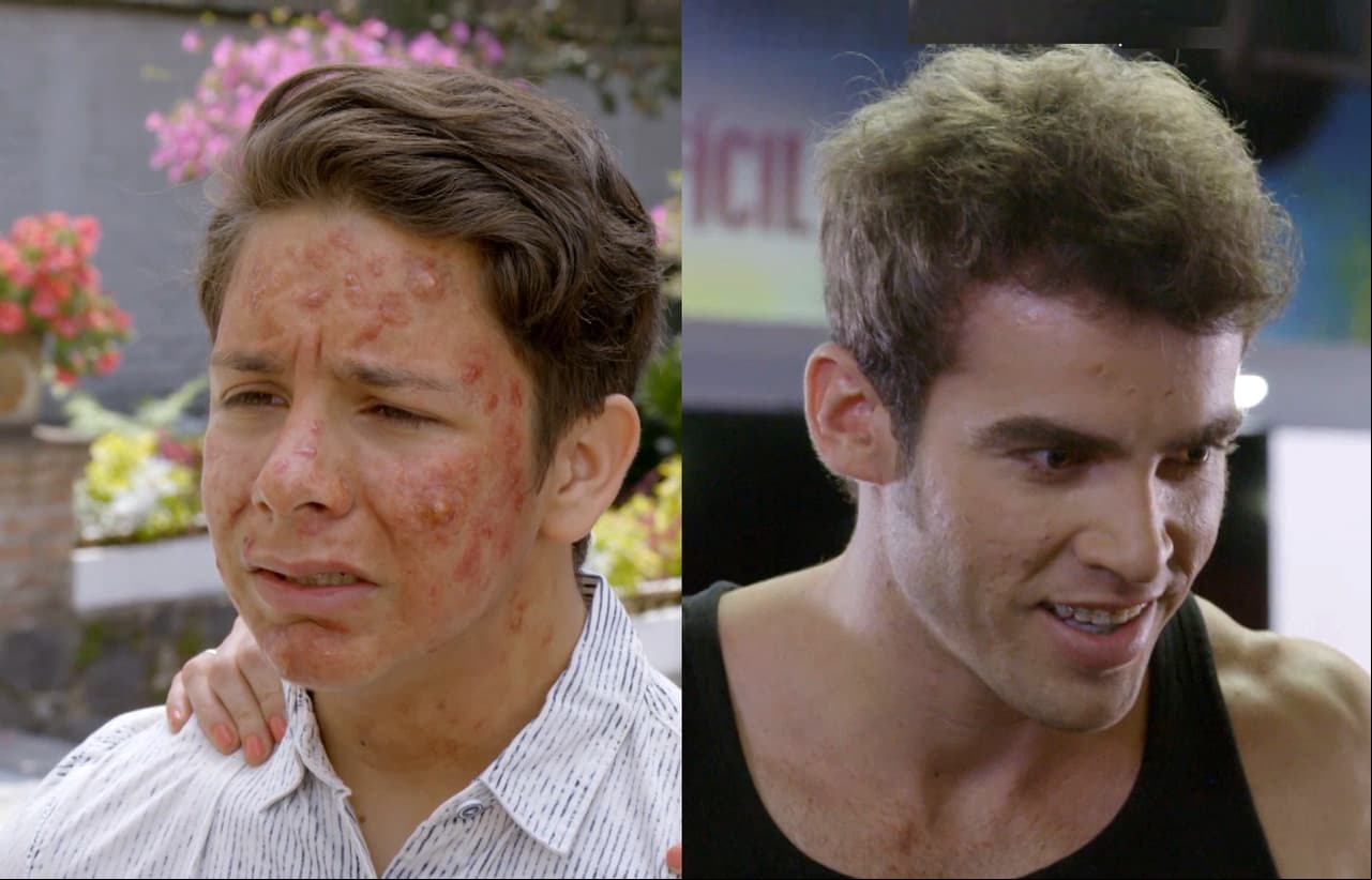 En 'El Monstruo', Mario vive atormentado porque le salen muchos barritos en la cara durante su adolescencia, pero años después, se transforma completamente y es cuando se da el lujo de rechazar a la ex novia que lo terminó.