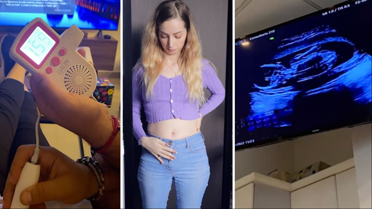 YosStop conmueve al mostrar los latidos y ultrasonido de su bebé