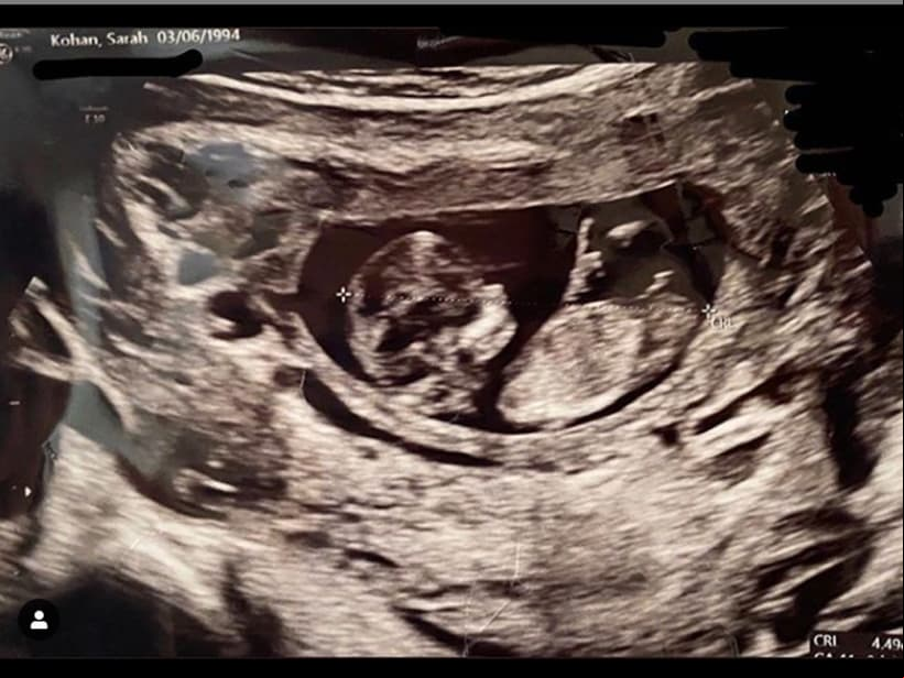 Sarah Kohan presume el ultrasonido de su bebé