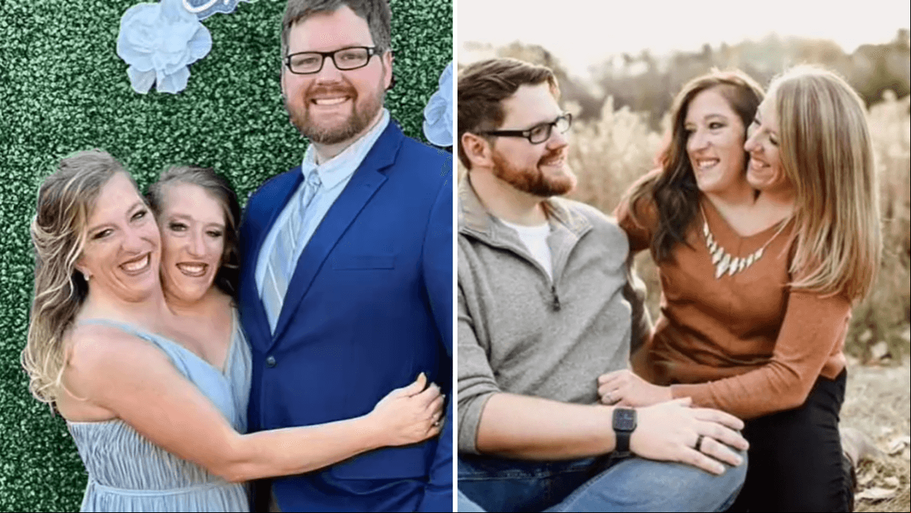 ¿Cómo es la vida de las siamesas Abby y Brittany Hensel? Una de ellas ya está casada