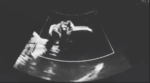 Aunque en su posteo de Instagram, el cual fue acompañado de un ultrasonido, la cantante no abundó en detalles sobre su esposa, sí mencionó que la había conocido hace siete años y posteriormente, indicó que se habían casado.