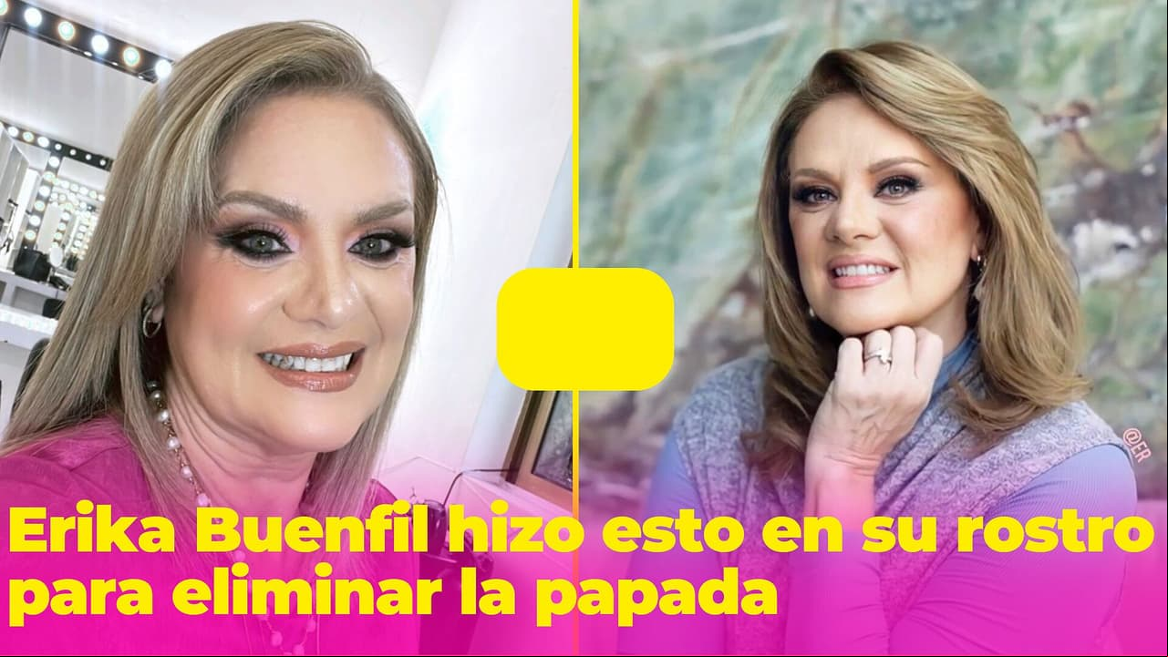 Erika Buenfil itió hacerse este 'arreglito' para eliminar su papada