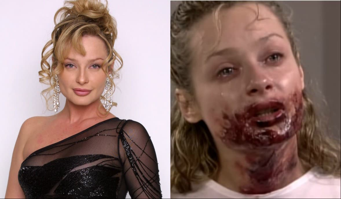 En amigas y Rivales, Roxana (Johana Benedeck) tuvo su merecido cuando al intentar dañar a Jimena (Ludwika Paleta), esta villana cae en su propia trampa cuando en un forcejeo se arroja acido sulfúrico en el rostro, quitándole su belleza y dejándola desfigurada.