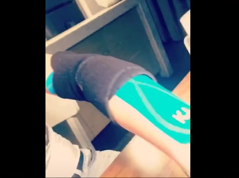 Kate sufre un percance durante una grabación