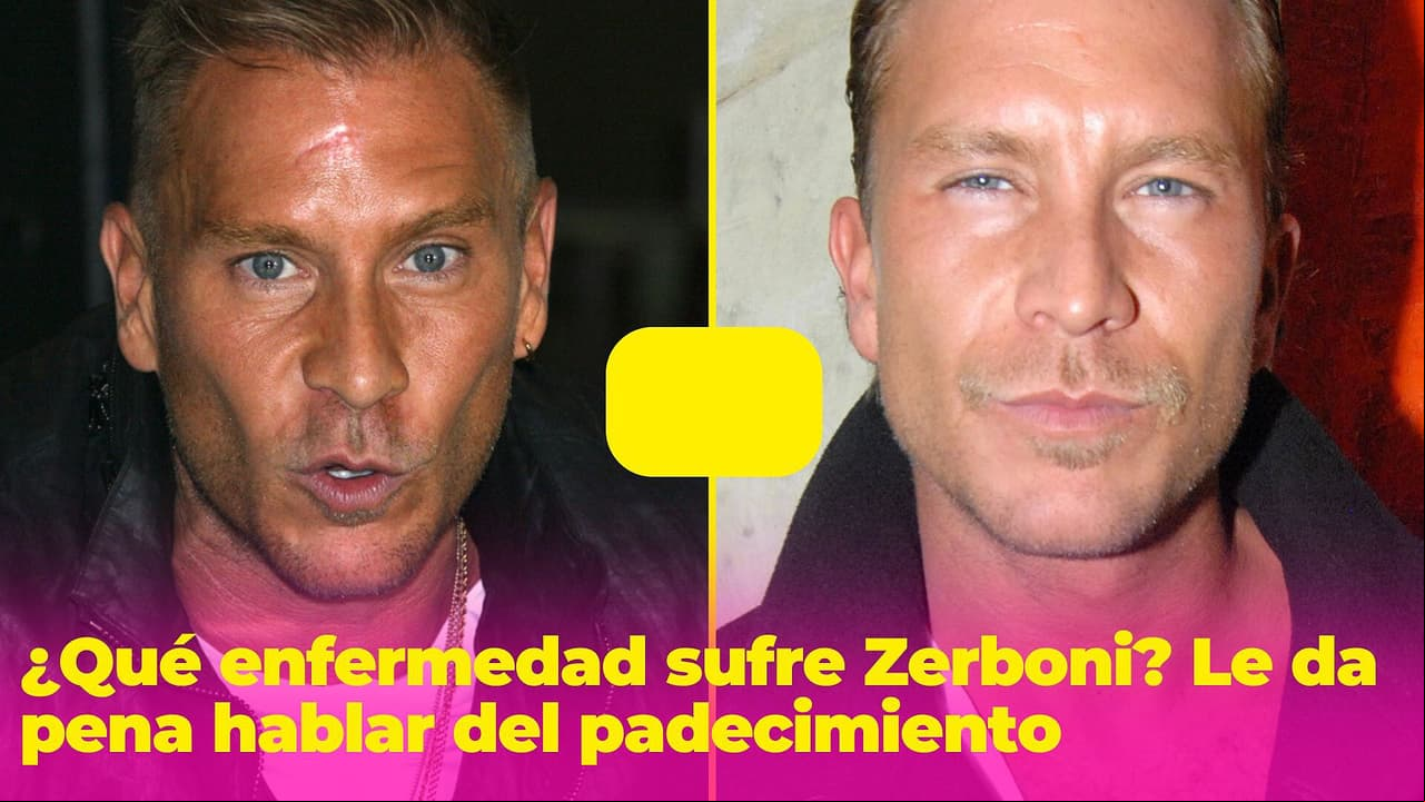 Salvador Zerboni padece una enfermedad, pero le avergüenza hablar de ella: ¿qué problema tiene?