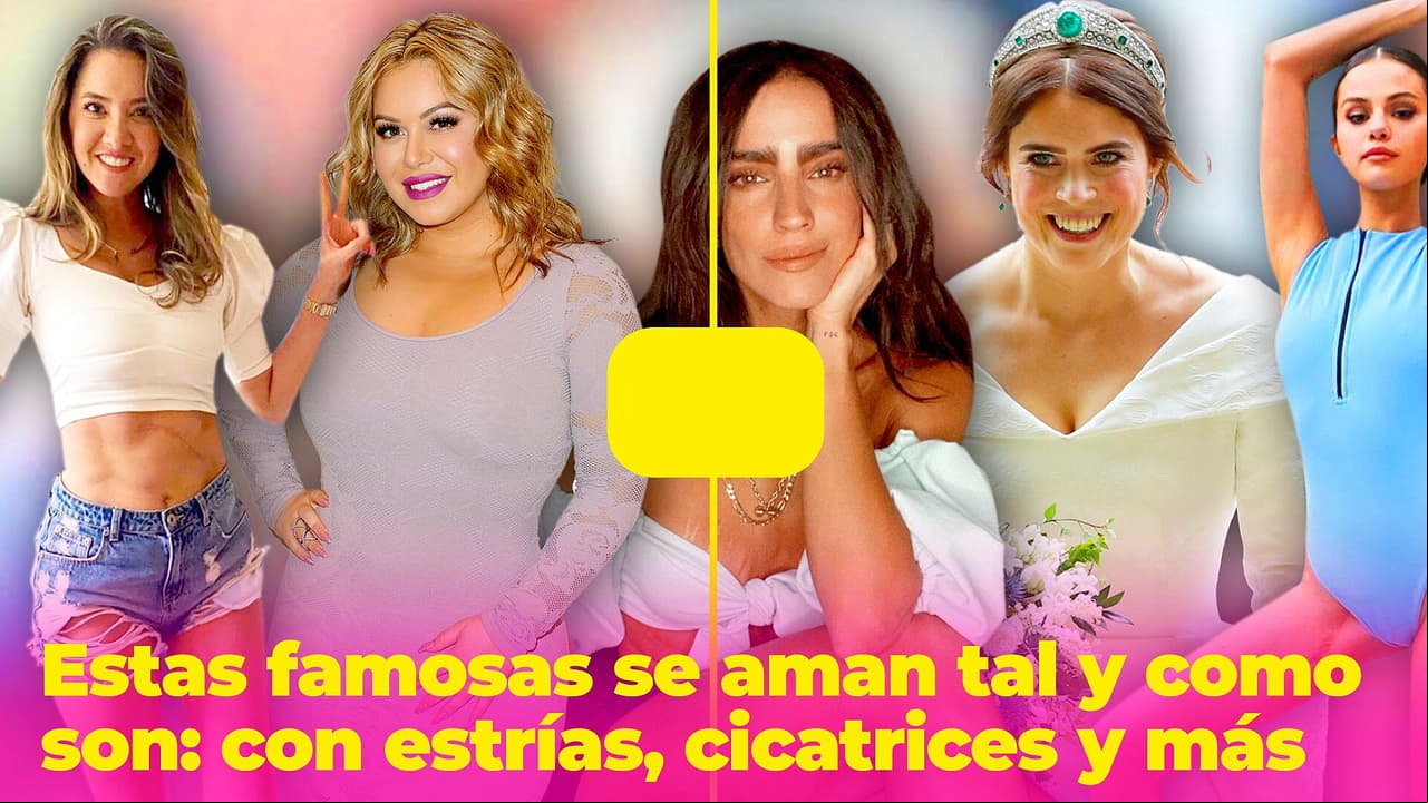 Con estrías, cicatrices, celulitis, canas y amputaciones: estas famosas se aman tal y como son