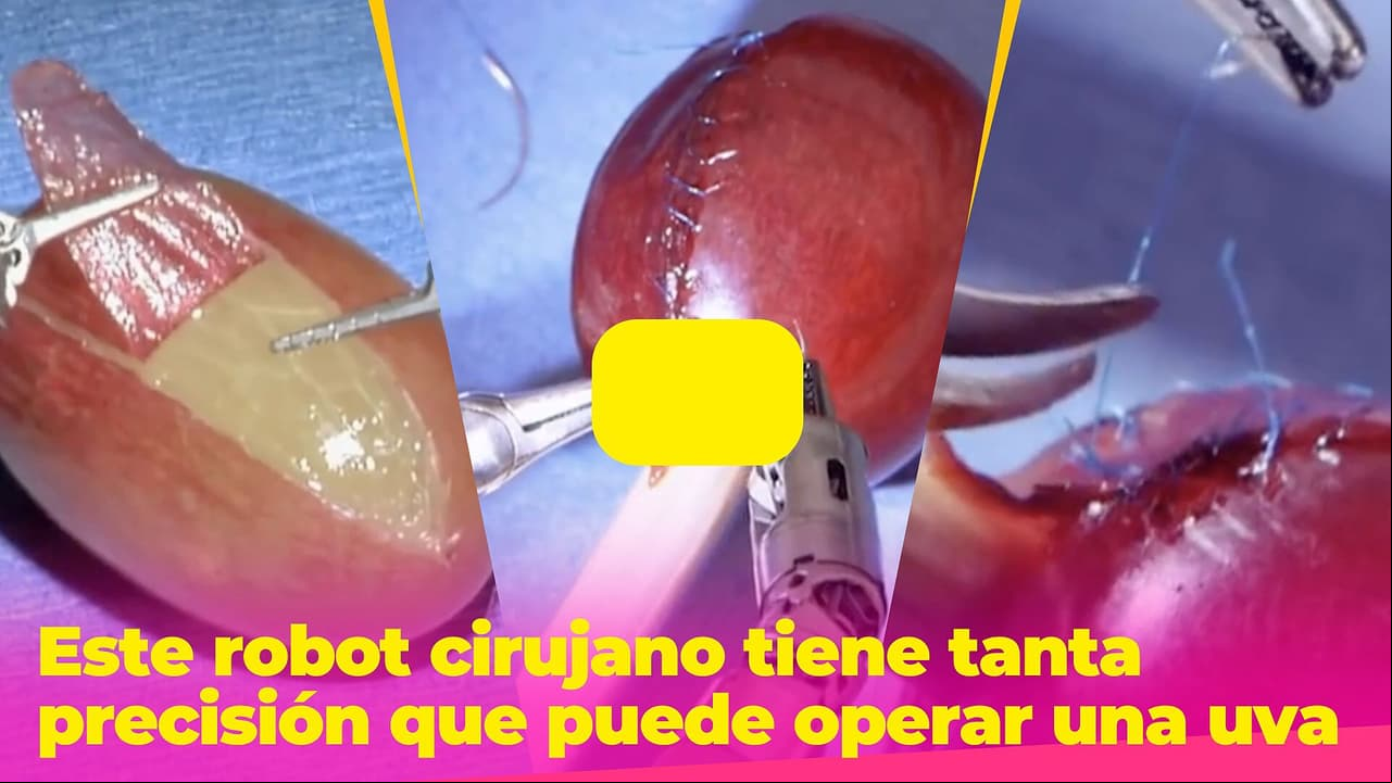 Este robot cirujano tiene tanta precisión que puede operar una uva: no podrás dejar de verlo