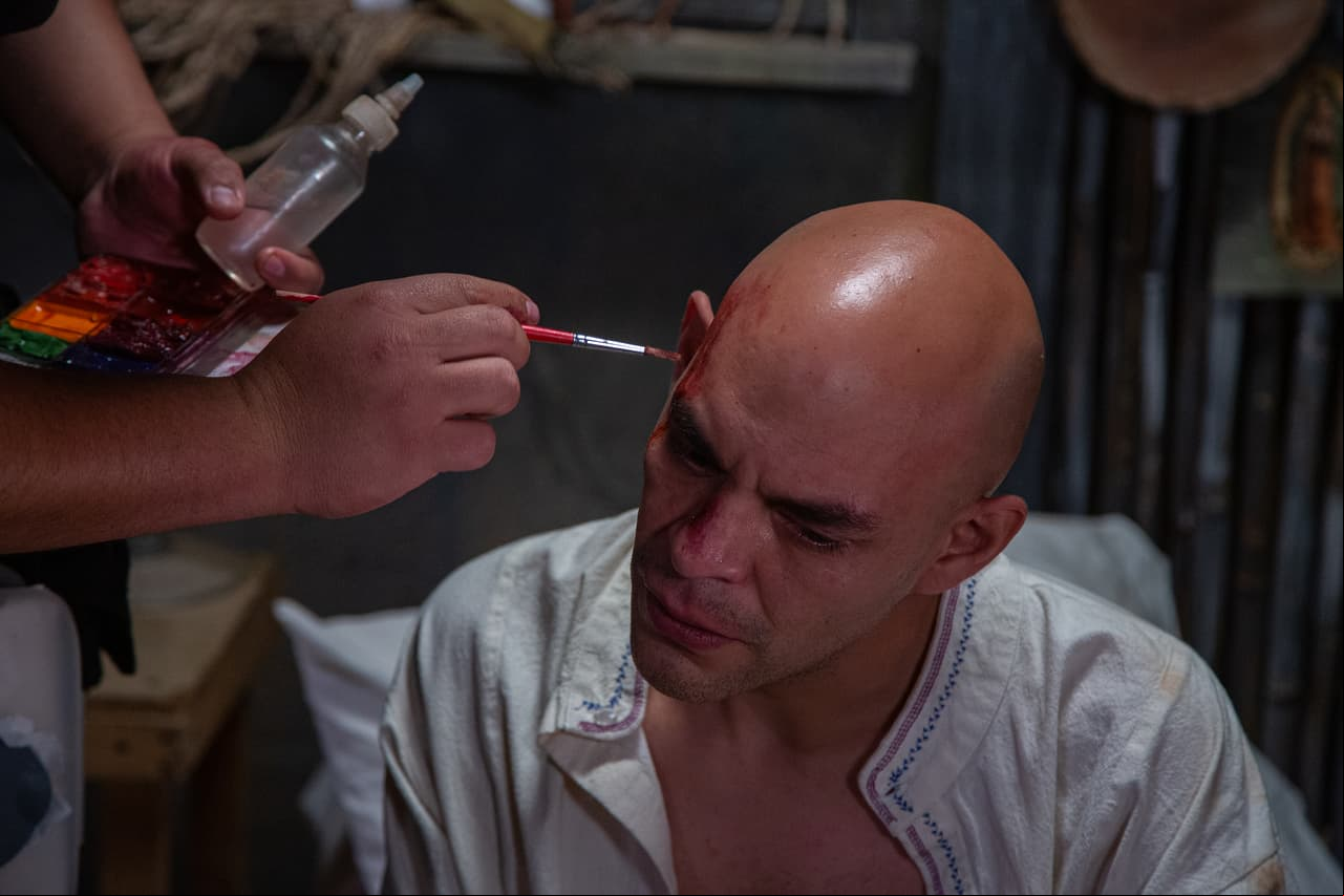 'Remi' tuvo que presentar diversas marcas en el rostro, las cuales fueron logradas por un artista del maquillaje.