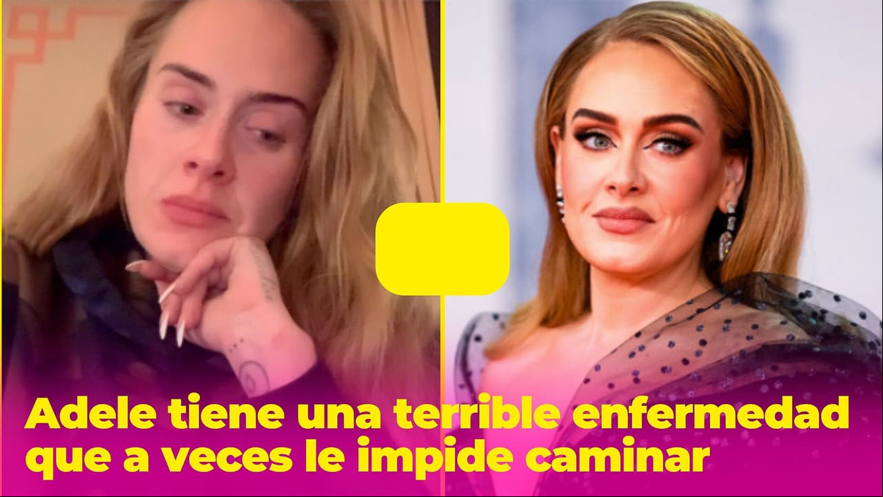Adele tiene un terrible padecimiento que a veces le impide caminar: lleva años soportándolo