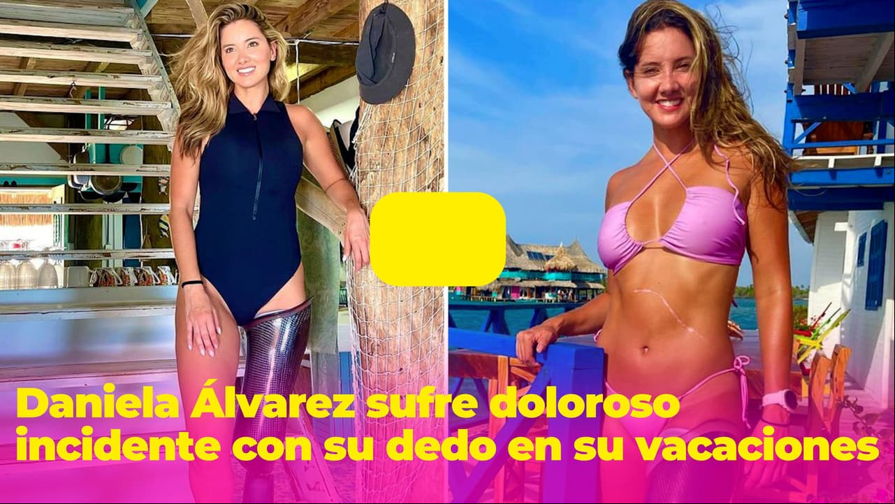 "Me va a amputar el dedo": Daniela Álvarez grita de dolor por incidente en medio de sus vacaciones