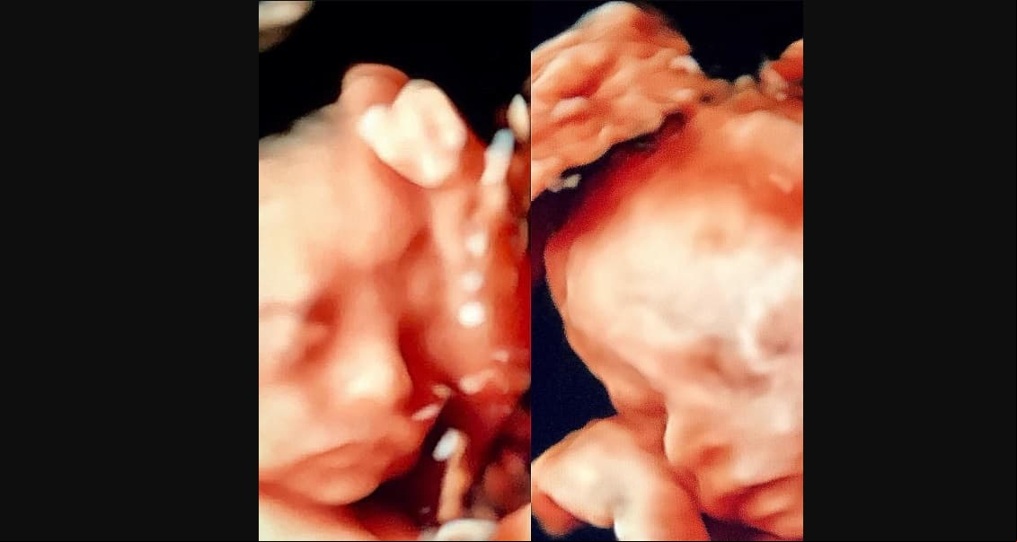 Compartieron la primera fotografía de sus mellizos y les preguntaron a sus iradores a quién creían que se parecían los bebés.