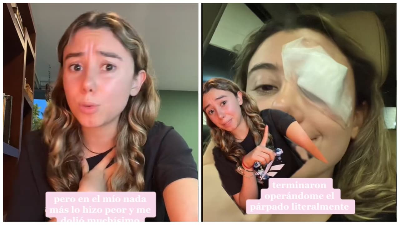 Joven termina en el quirófano por "truco de belleza" que vio en TikTok: video viral
