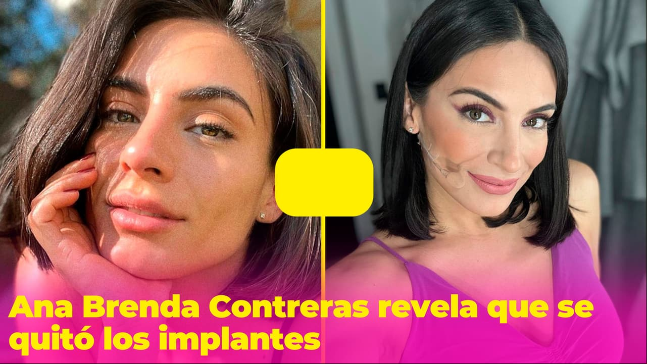 Ana Brenda Contreras muestra que se quitó los implantes mamarios: compartió fotos desde el hospital