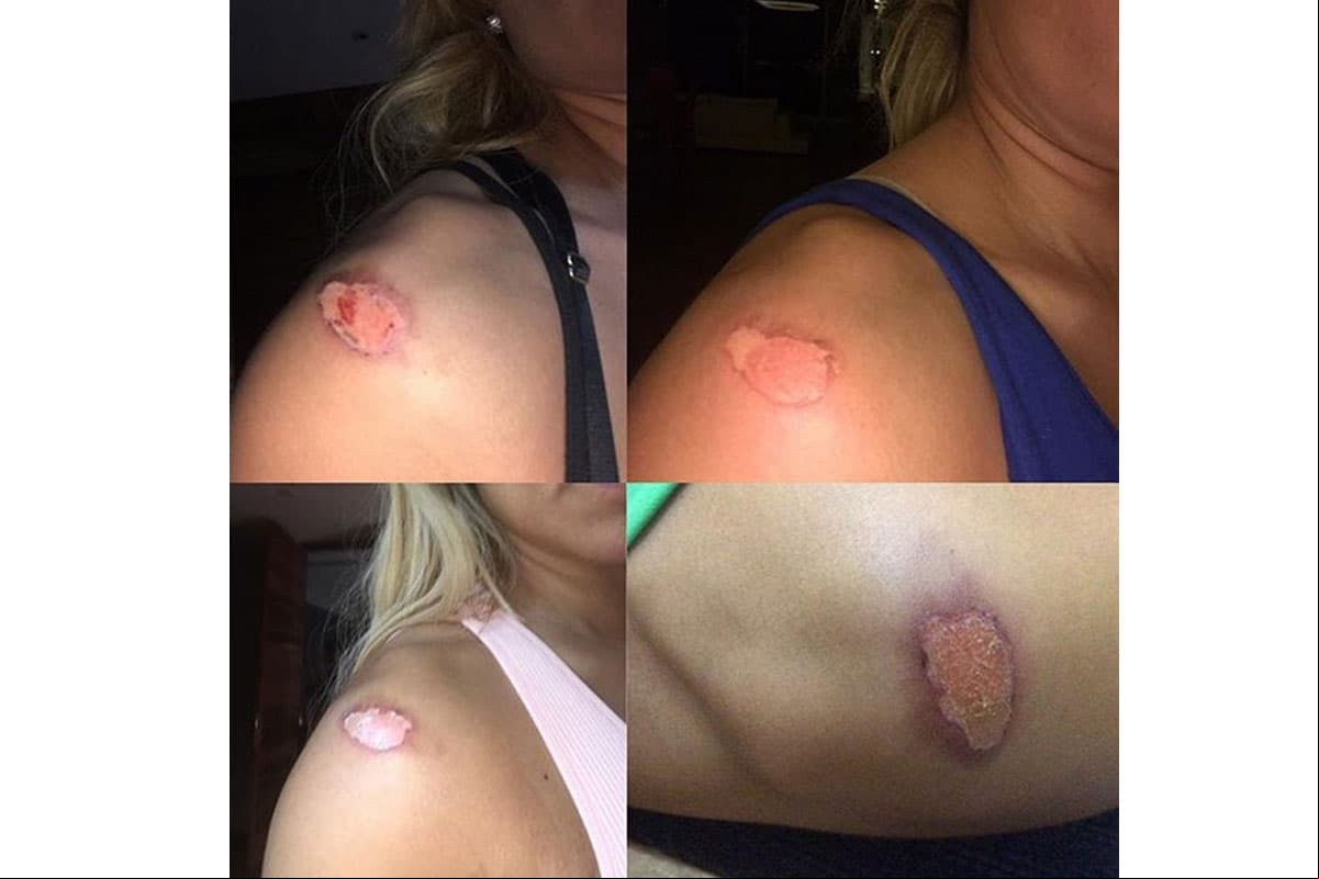 Aleida Núñez publicó lesión en Instagram