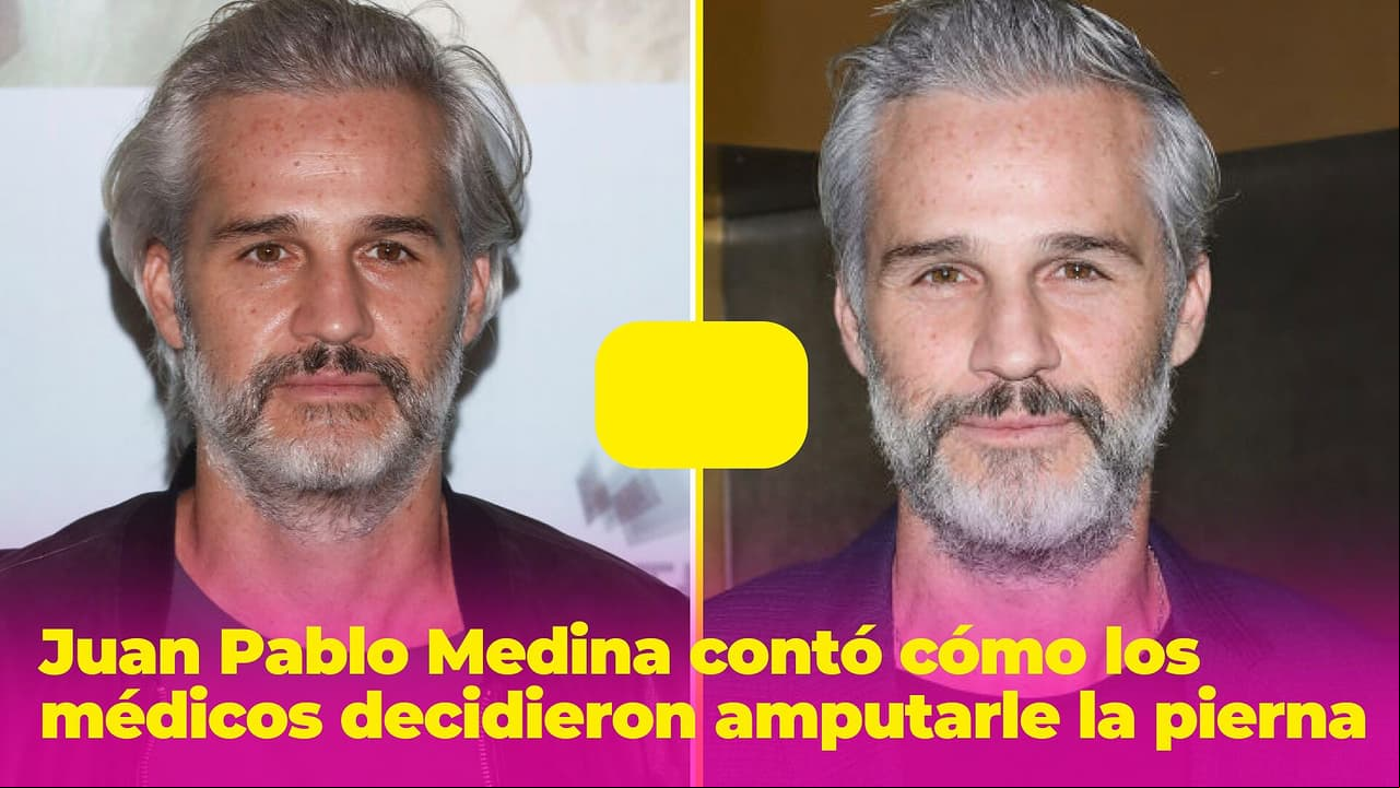 "Pensaban que era intoxicación": Juan Pablo Medina contó cómo los médicos decidieron amputarle la pierna