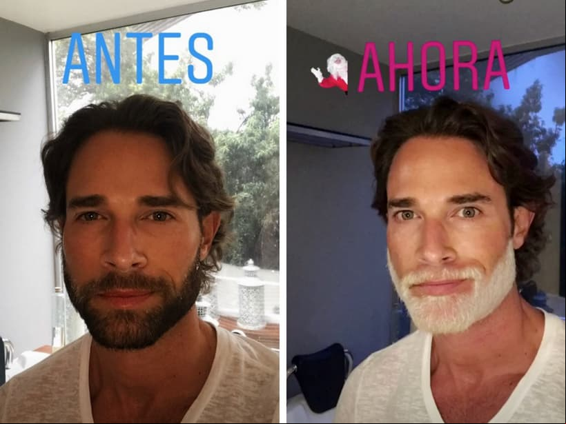 Antes y después